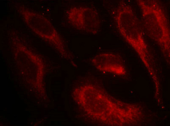 HSF1 Antibody
