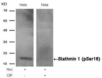 STMN1 Antibody