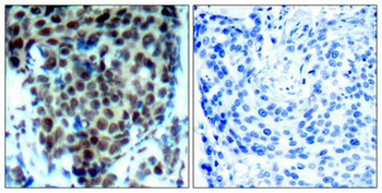 MAPK14 Antibody