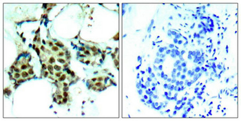 MAPK14 Antibody