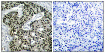 HSF1 Antibody