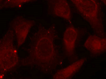NF2 Antibody