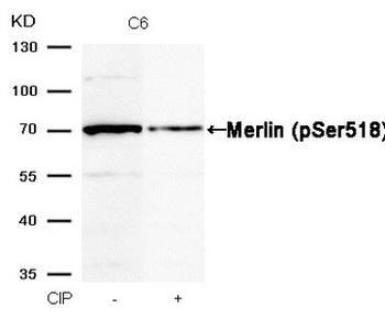 NF2 Antibody