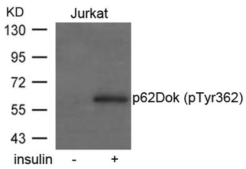 DOK1 Antibody