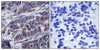 DOK1 Antibody