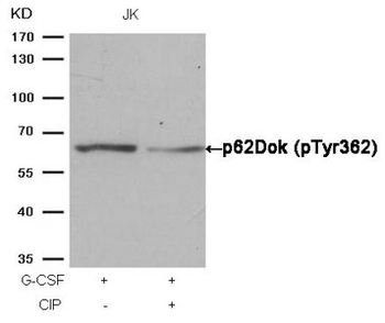 DOK1 Antibody
