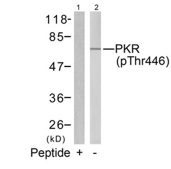 EIF2AK2 Antibody