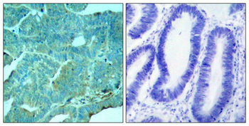 EIF2AK2 Antibody
