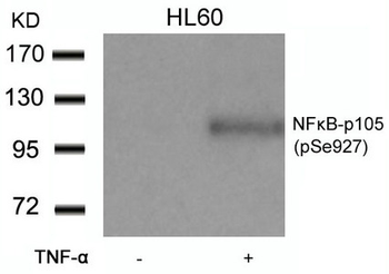 NFKB1 Antibody