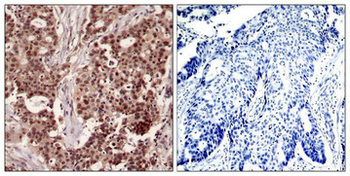NFKB1 Antibody