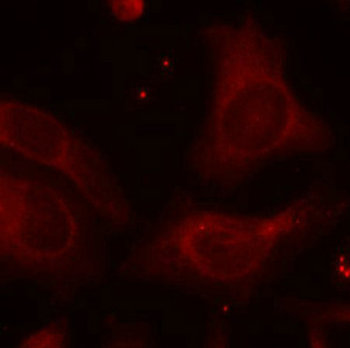 NFKB1 Antibody
