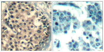 HDAC4/HDAC5/HDAC9 Antibody
