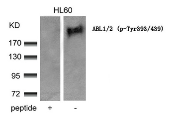 ABL1/ABL2 Antibody