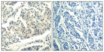 ABL1/ABL2 Antibody