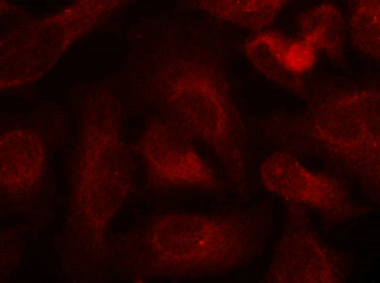 ABL1/ABL2 Antibody