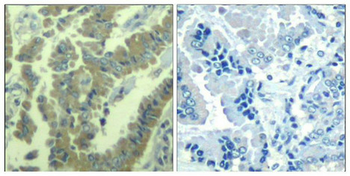 MARCKS Antibody