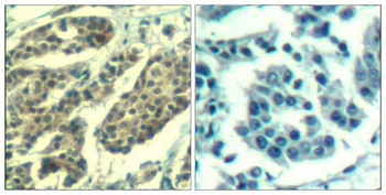 CCNB1 Antibody