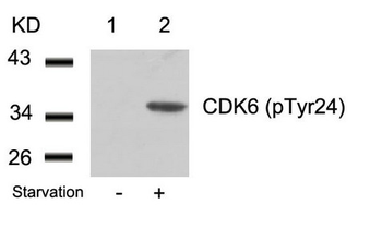 CDK6 Antibody