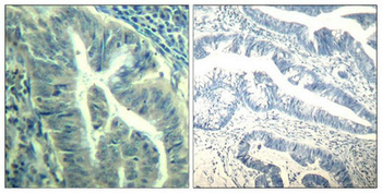 CDK6 Antibody