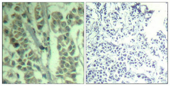 CBL Antibody