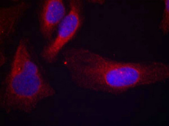 CBL Antibody