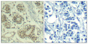 MDM2 Antibody