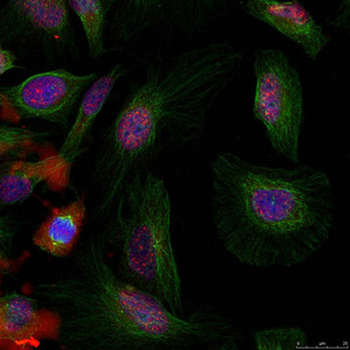 MDM2 Antibody