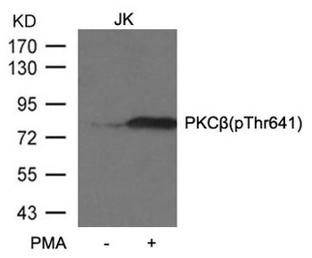 PRKCB Antibody