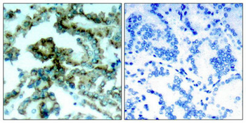 PRKCB Antibody