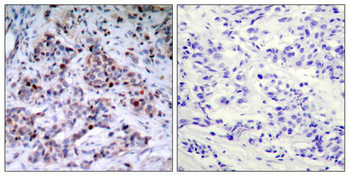 RELA Antibody