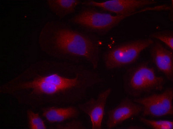 NFKB2 Antibody