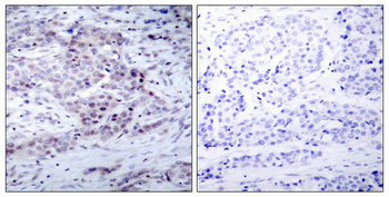 NFKB2 Antibody