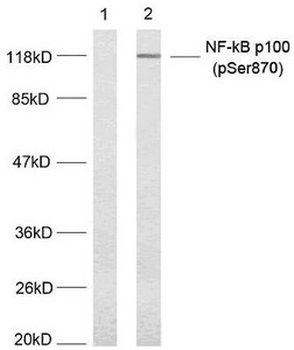 NFKB2 Antibody