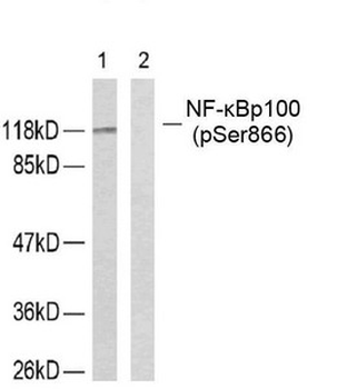 NFKB2 Antibody