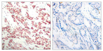 NFKB2 Antibody