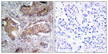 PTEN Antibody
