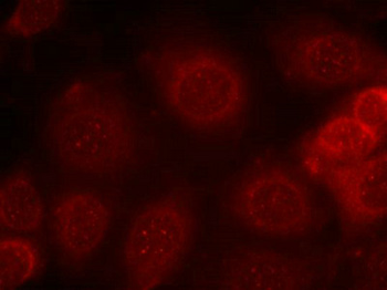 PTEN Antibody