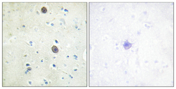 APP Antibody