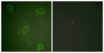 APP Antibody