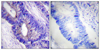 PRKACA Antibody