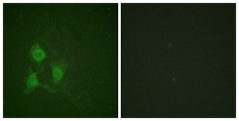 PRKACA Antibody