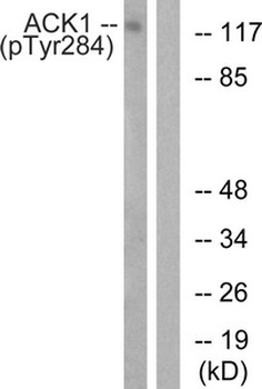 TNK2 Antibody