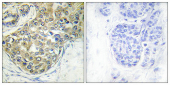 TNK2 Antibody