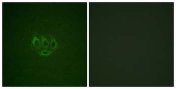 TNK2 Antibody