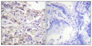 HNRNPD Antibody