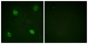 HNRNPD Antibody