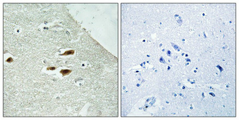 PER2 Antibody