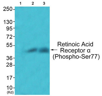 RARA Antibody