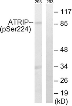 ATRIP Antibody