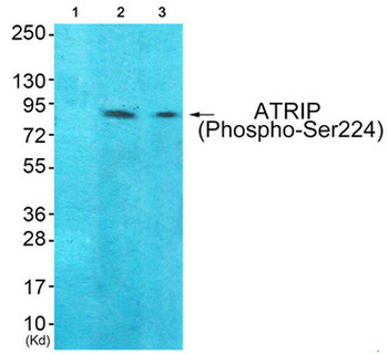 ATRIP Antibody